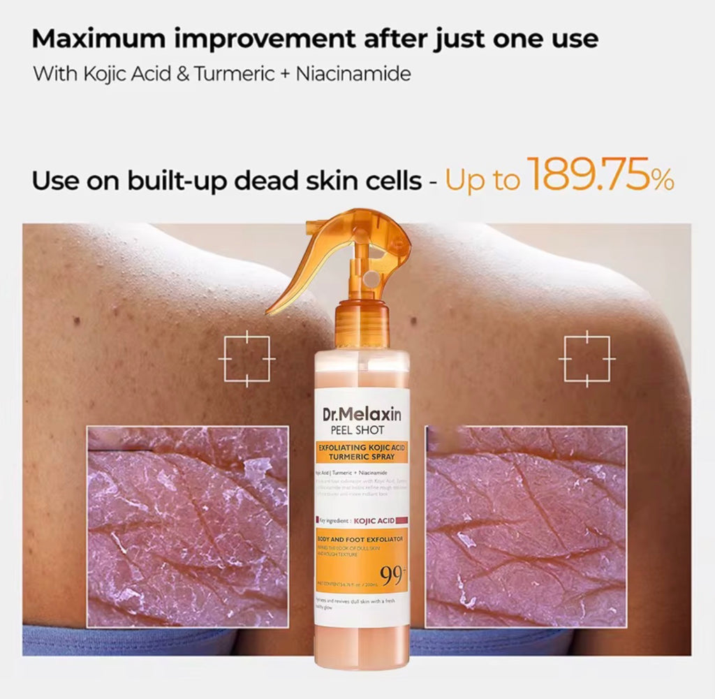 Kojic Acid Turmeric Exfoliating Spray – 200ml