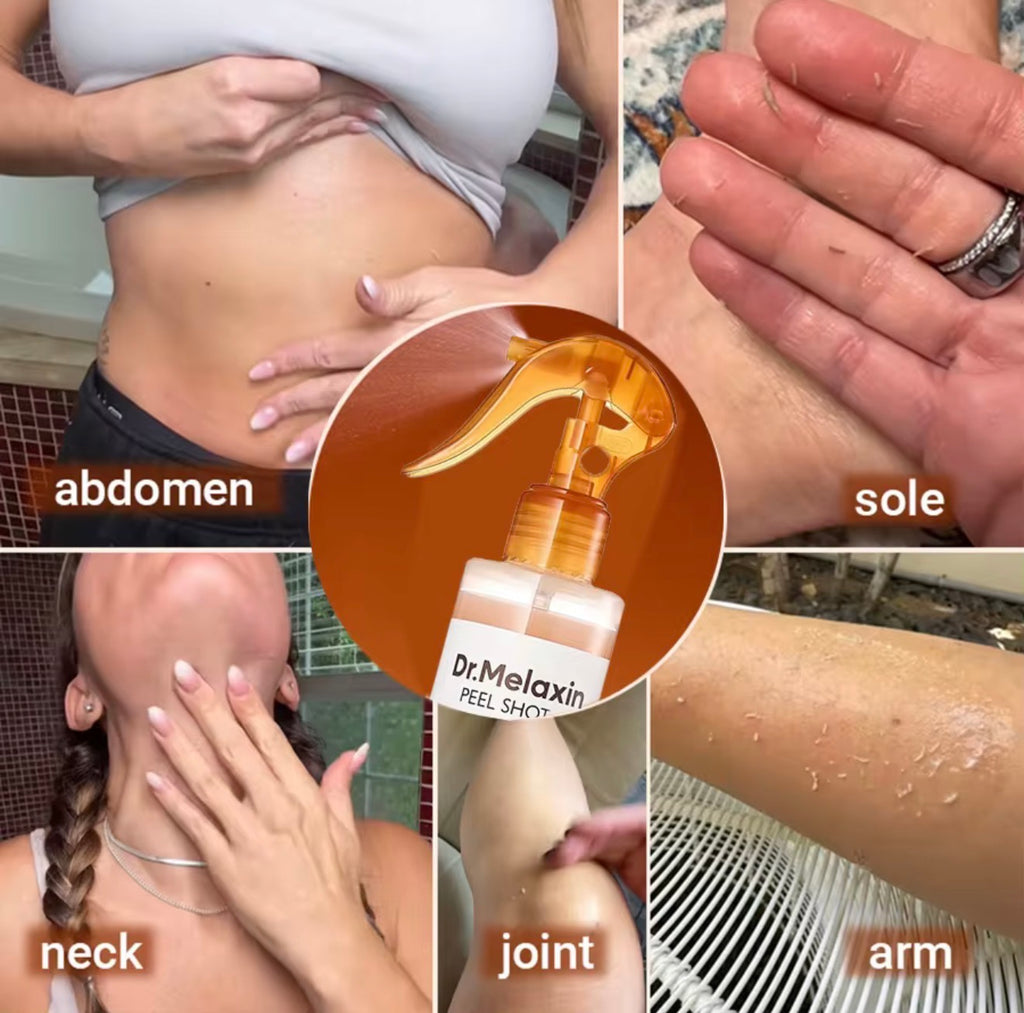 Kojic Acid Turmeric Exfoliating Spray – 200ml